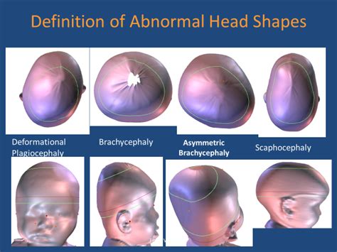 abnormal shaped head.